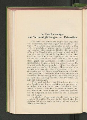 V. Erschwerungen und Verunmöglichungen der Extraktion.