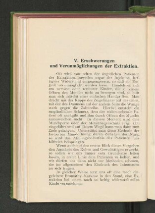 V. Erschwerungen und Verunmöglichungen der Extraktion.