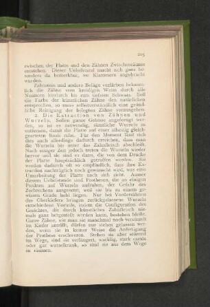 2. Die Extraction von Zähnen und Wurzeln.
