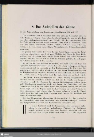 8. Das Aufstellen der Zähne