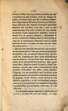 Mémoire sur un enfant bicéphale