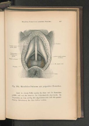 Fig. 394. Männliches Perineum mit präparirter Harnröhre.