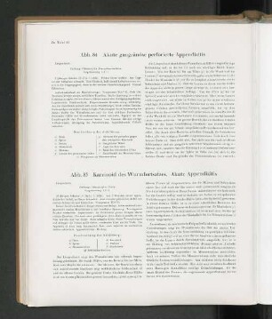 Abb. 85 Karzinoid des Wurmfortsatzes. Akute Appendizitis