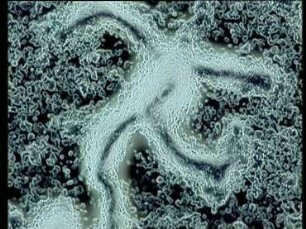 cAMP induzierte Aggregation von Dictyostelium