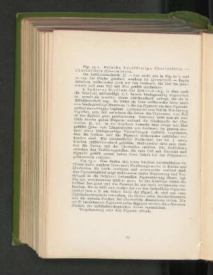 Fig. 79 a. Frische herdförmige Chorioditis - Choriodita disseminata. Fig. 79 b. Späteres Stadium der Erkranung. Fig. 79 c. Narbengewebe in Retina und Chorioidea.