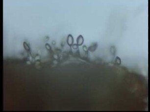 Lebenszyklus des Rostpilzes Puccinia graminis
