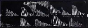 [Graphical recordings: fatigue]
