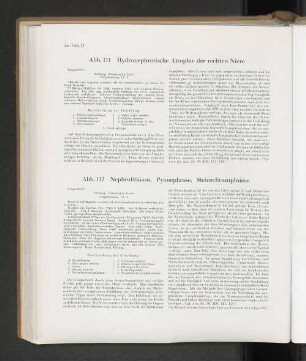 Abb. 111 Hydronephrotische Atrophie der rechten Niere