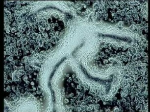 cAMP induced aggregation of Dictyostelium