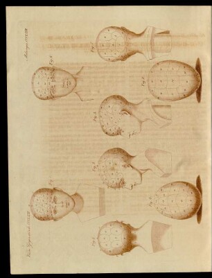 Die Gehirn- und Schädel-Lehre Gall's und Spurzheim's.