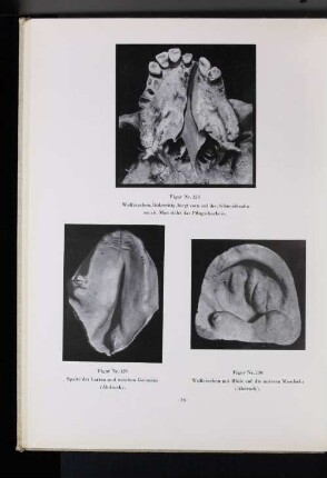 Figur Nr. 129 Spalte des harten und weichen Gaumens (Abdruck).