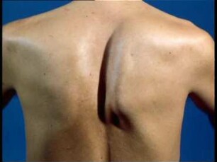 Orthopädische Krankenuntersuchung - Schulter