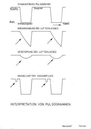 Interpretation von Pulsogrammen