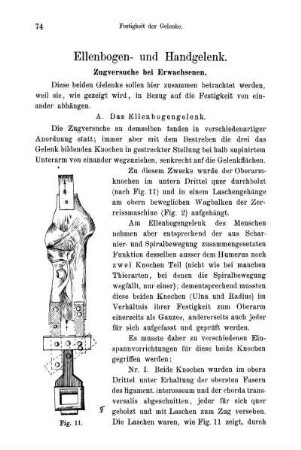 Ellenbogen- und Handgelenk.