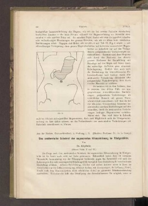 Das anatomische Substrat der sogenannten Hiluszeichnung im Röntgenbilde.