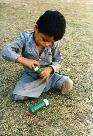 Afghanisches Kind verkrüppelt : Durch eine sowjetische Spielzeugbombe verkrüppeltes afghanisches Kind, aufgenommen 1986 in einem Flüchtlingslager in Pakistan