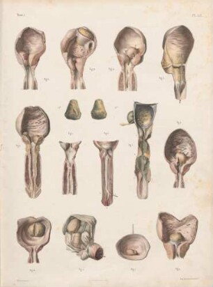 Krankheiten an der Harnröhre, an der Prostata und der Blase