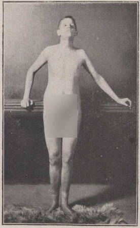 Fotografie, die den 19 jährigen P. zeigt (2)