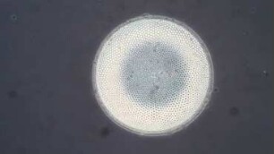 Coscinodiscus radiatus Helgoland 2019