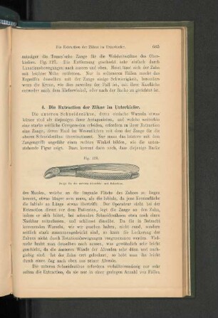 4. Die Extraction der Zähne im Unterkiefer.