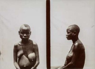 Frauenportrait : Anthropometrische Aufnahme einer Frau