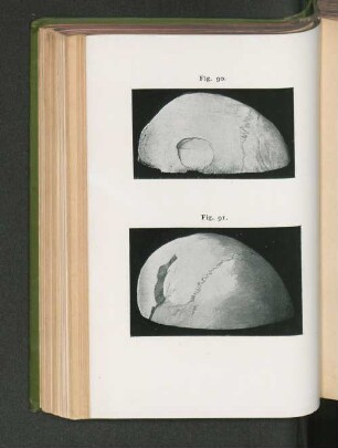 Fig. 90. Fig. 91.