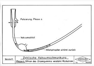 Zyklische Vakuumschwankung, Phase 4: Öffnen des Zitzengummis verstärkt Rückstrom