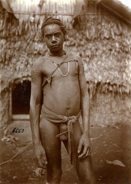 "Man with ornamental scars. East Malecula."