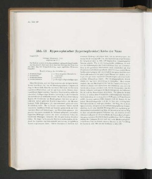 Abb. 121 Hypernephrischer (hypernephroider) Krebs der Niere