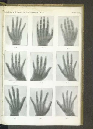 Tafel XVII.