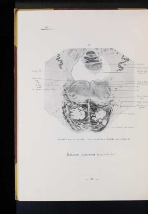197 Schnitt durch die Brücke. Austretende Nervi facialis und abducens.