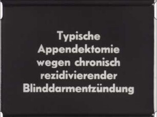 Typische Appendektomie wegen chronisch rezidivierender Blinddarmentzündung