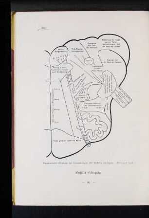 202 Diagnostische Hilfsfigur bei Erkrankungen der Medulla oblongata. (Edinger 1912.)