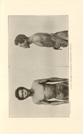 Plate XV. Pure Negrito of Zambales, Showing hair on the Chin