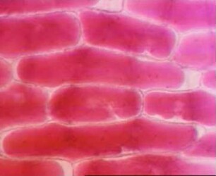 Plasmolyse - Allium cepa