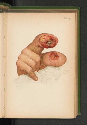 Tab. 19.