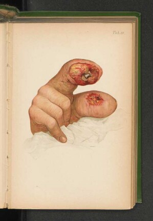Tab. 19.