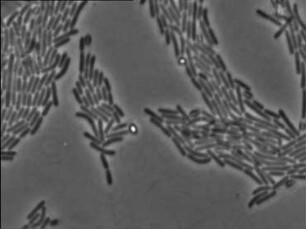 Clostridium tetani - Vermehrung und Bewegung