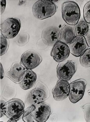 Chromosomen einer Lilie, ca. 1000-fach vergrößert, Mikrofotografie