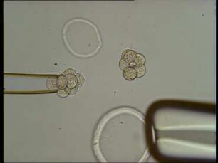 Biotechnics in Reproduction - Micromanipulation of Oocytes and Embryos in Mice