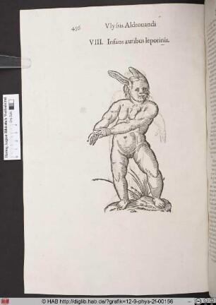 Infans auribus leporinis.