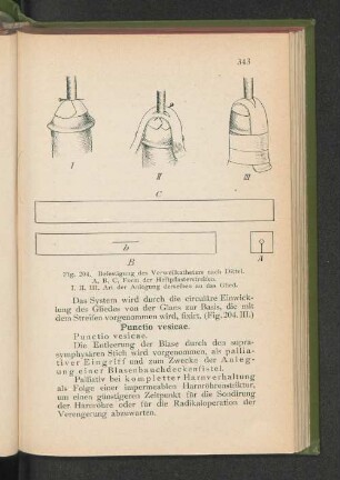 Punctio vesicae.