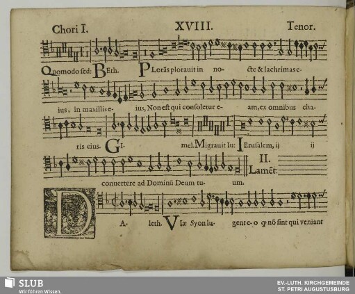 XVIII. II. Lamentatio: Daleth viae Sion lugent