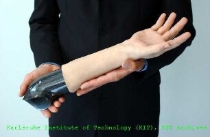 Unterarmprothese des Instituts für Angewandte Informatik (IAI)