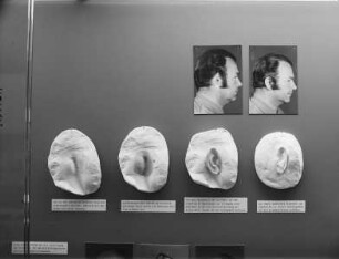 Anatomische Modelle und fotografische Ansichten: Ohr und Ohrepithesen