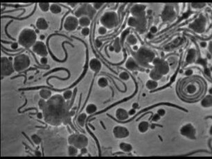 Proteus - Hemmungsformen durch Penicillinwirkung