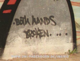 BoTh HANDS BRoKEN