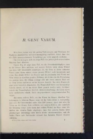 B. Genu Varum