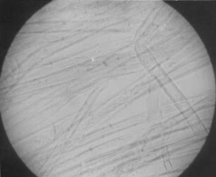 Zellulose aus Braunkohle (R. Potonié) : Geologie | Kohlengeologie | Das mikroskopische Bild der Kohle (Mikroskopische Kohlenpetrographie)