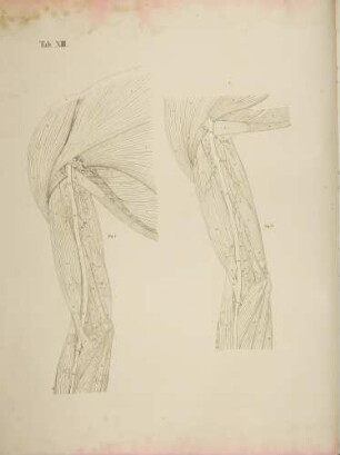 Abweichungen der tiefen Armpulsader und der seitlichen Arterie des Ellenbogens (Lineartafel)